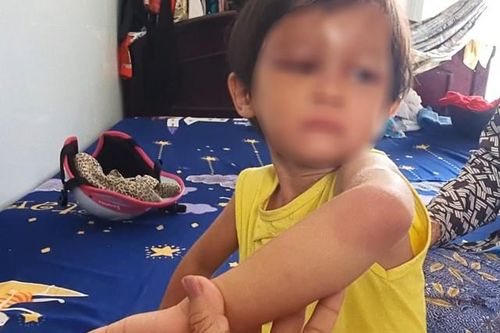 Bắt tạm giam cha nuôi hành hạ bé gái 4 tuổi ở Cà Mau