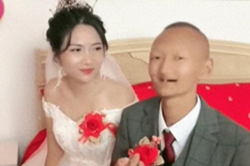 Chú rể 'xấu lạ' cưới được cô dâu xinh như diễn viên