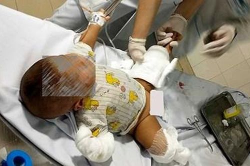 Ném 'bom xăng' vào nhà con nợ khiến 3 người bị thương