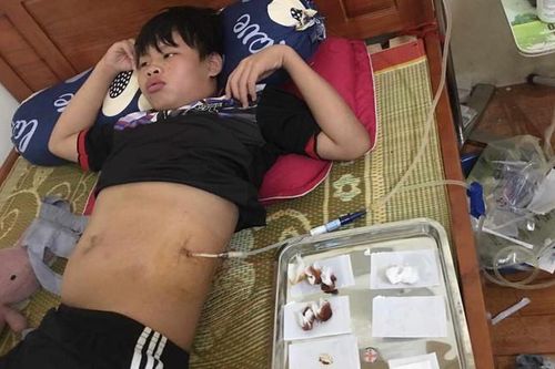 Hoàn cảnh đáng thương của nam sinh lớp 9 xin ra viện về nhà tự chạy thận