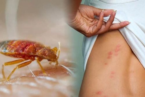Cách phòng chống và diệt loài rệp giường