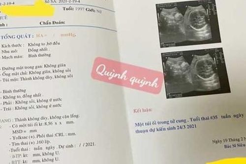 Thừa Thiên-Huế: Triệt phá đường dây mang thai hộ và mua bán thận liên tỉnh