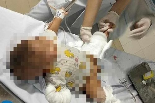 Bắt giữ đối tượng ném chai xăng vào nhà dân khiến 3 người bị thương