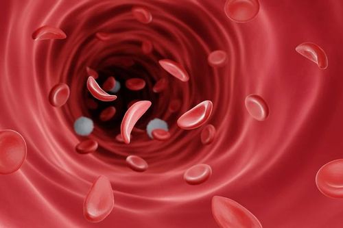 Nước đầu tiên cấp phép liệu pháp gene điều trị bệnh thiếu máu do di truyền
