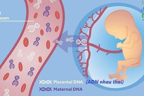 Các dị tật bẩm sinh thường gặp ở trẻ sơ sinh