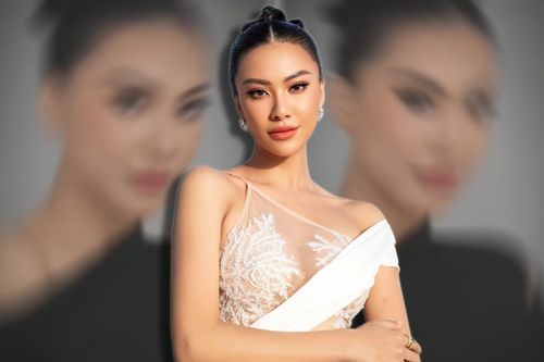 Dính nghi vấn can thiệp 'dao kéo', Kim Duyên có hành động đáp trả gây chú ý