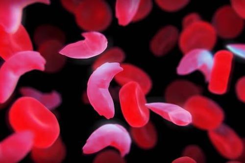 Thuốc chỉnh sửa gene đầu tiên trên thế giới hoạt động thế nào?