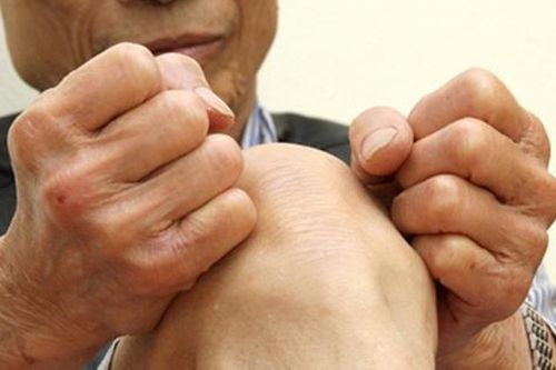 Cứng khớp gối cần làm gì?