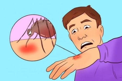 Lý do tại sao muỗi thích đốt một số người và 6 cách xua đuổi chúng