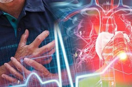 Dấu hiệu cảnh báo nhồi máu cơ tim trước vài ngày