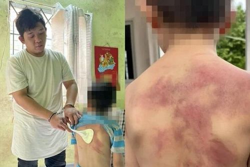 Bé trai 5 tuổi bị cha ruột hành hạ dã man: Hành vi mất nhân tính