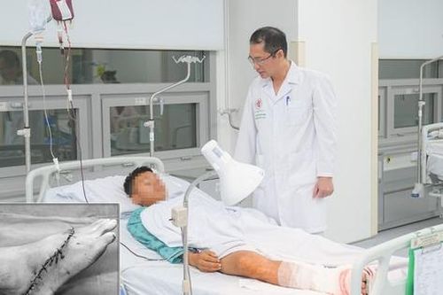 Liên tiếp xảy ra tai nạn kinh hoàng từ máy cắt cỏ