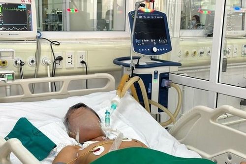 Hà Nội ghi nhận 3 trường hợp tử vong do uốn ván