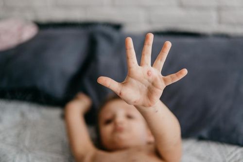 Phòng ngừa các bệnh truyền nhiễm dễ lây và gây tổn hại da như thế nào?