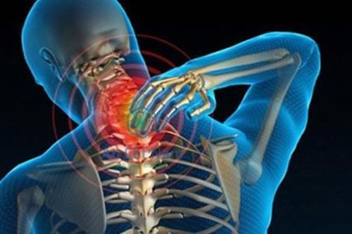 Bệnh thoái hóa cột sống cổ ai dễ mắc?