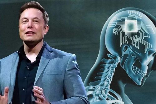 Dự án Neuralink của tỷ phú Elon Musk gây tranh cãi