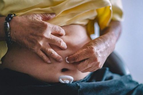 4 nguyên nhân khiến rốn có mùi hôi và cách vệ sinh rốn đúng cách