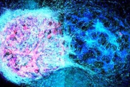 In 3D sinh học đem lại hy vọng điều trị chấn thương não