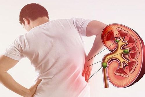 Bác sĩ trả lời: Sau tán sỏi thận, bị nhiễm trực khuẩn mủ xanh có nguy hiểm không?