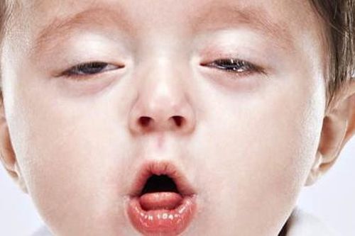 Hà Nội phát hiện bệnh nhân ho gà là trẻ sơ sinh 6 tuần tuổi