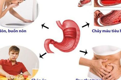 Những dấu hiệu điển hình của đau dạ dày