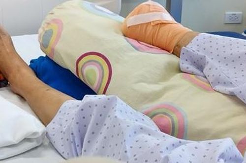 Dùng kim chích vết thương để tự nặn mủ, người phụ nữ phải cắt cụt bàn chân