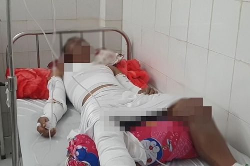 Nổ lớn trên ghe biển, 3 người bị thương nặng