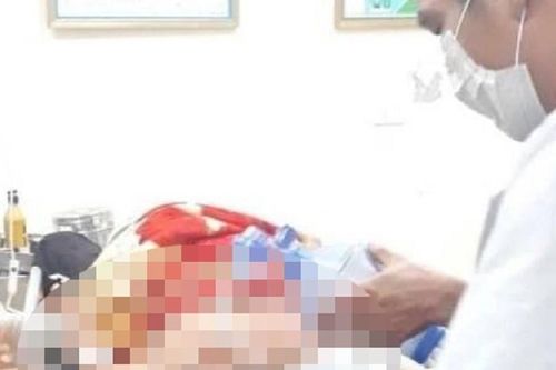 Mâu thuẫn tại đám cưới, nam thanh niên bị đâm tử vong