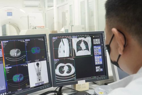 Thực hiện ghi hình PET/CT với 2 loại thuốc phóng xạ mới