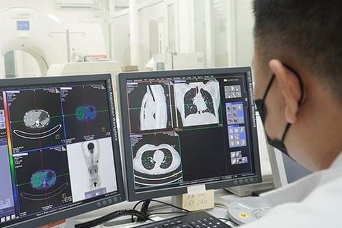 Pha chế thành công 2 loại thuốc phóng xạ trong chẩn đoán ung thư