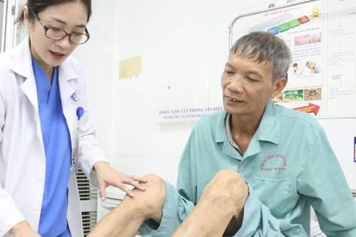 Suy giãn tĩnh mạch chân có thể phải ngồi xe lăn nếu điều trị không đúng cách