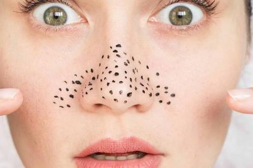 Xử lý thế nào khi lỗ chân lông to?