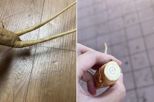 Đào được 'nhân sâm', cô gái hôn mê suýt chết vì điều này