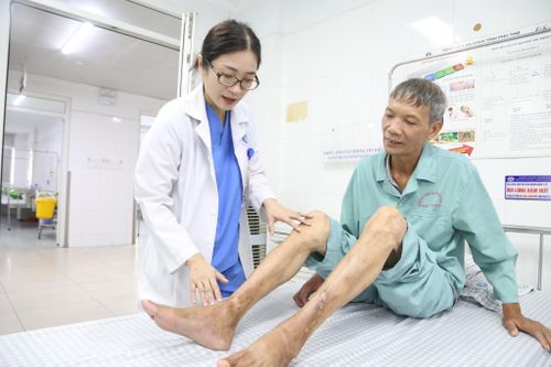 Chân tím đen, lở loét do suy giãn tĩnh mạch