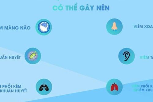 Những sự thật về phế cầu khuẩn có thể bạn chưa biết