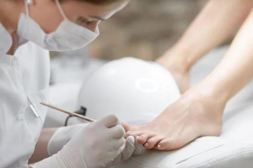 Chăm sóc móng chân y tế - liệu pháp lý tưởng cho một đôi chân khỏe, đẹp