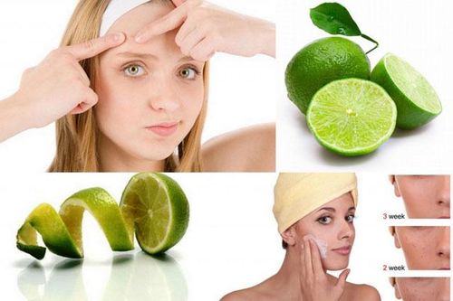 Sạch mụn, sáng da chỉ cần 1 quả chanh tươi