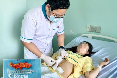 Phẫu thuật lấy sỏi san hô phức tạp cho bệnh nhân bị dị tật hiếm gặp