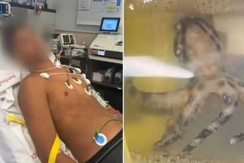 Nhặt vỏ sò, chàng trai đụng độ 'thủy quái' độc hơn rắn hổ mang