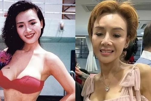Biểu tượng gợi cảm Hong Kong Diệp Tử My chỉ còn 36 kg