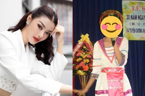 Một Á hậu 'lên hương' visual nhờ phẫu thuật thẩm mỹ, không ngại công khai ảnh hồi còn đen nhẻm
