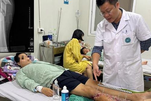 Cứu thanh niên bị tổn thương mạch máu nghiêm trọng do tai nạn giao thông