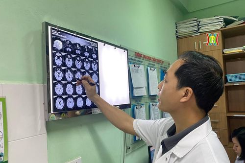 Phẫu thuật thành công ca Parkinson nặng nhờ kích thích não sâu
