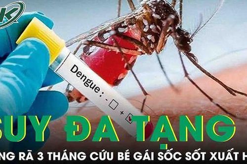 Ròng rã 3 tháng điều trị tích cực cho bé gái sốc sốt xuất huyết nặng, suy đa tạng