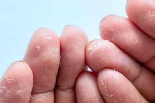 Bong tróc da đầu ngón tay: Nguyên nhân, cách điều trị và phòng ngừa
