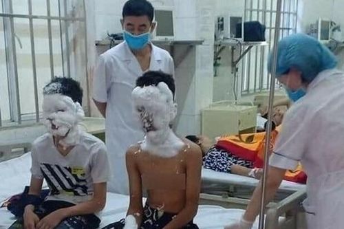 Hiểm họa khôn lường từ pháo nổ tự chế