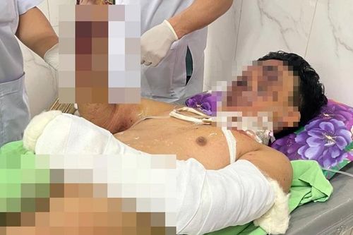 Cháu bé 12 tuổi bị dập nát 2 bàn tay nghi do pháo nổ