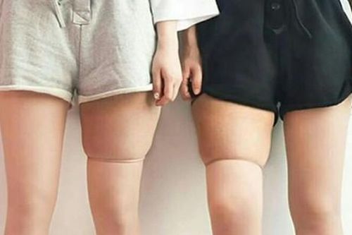 Thường xuyên dùng tất thon chân, nữ giám đốc cầu cứu bác sĩ