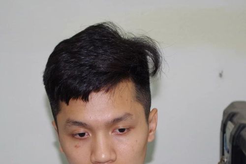 Hà Nam: Tạm giữ lái xe ôtô đâm vào Cảnh sát Giao thông đang làm nhiệm vụ