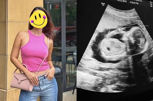 Một siêu mẫu đình đám công khai phiếu siêu âm thai, đặt nhiều tâm tư vào em bé trong bụng
